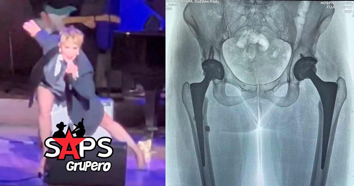 Tras fuerte caída Alejandra Guzmán muestra radiografía de su cadera